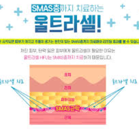 울트라셀 가격